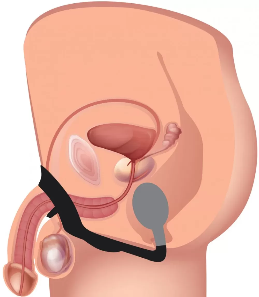Best Healthy & Active 10X P-Bomb Silicone Cock and Ball Ring with Vibrating Anal Plug